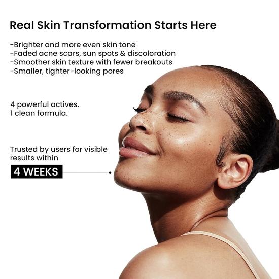 WILD OAK 2% Alpha Arbutin + 10% Niacinamide Face Serum | Alpha Arbutin Is Powerful For Pigmentation, Acne Scars & Spot | 30Ml