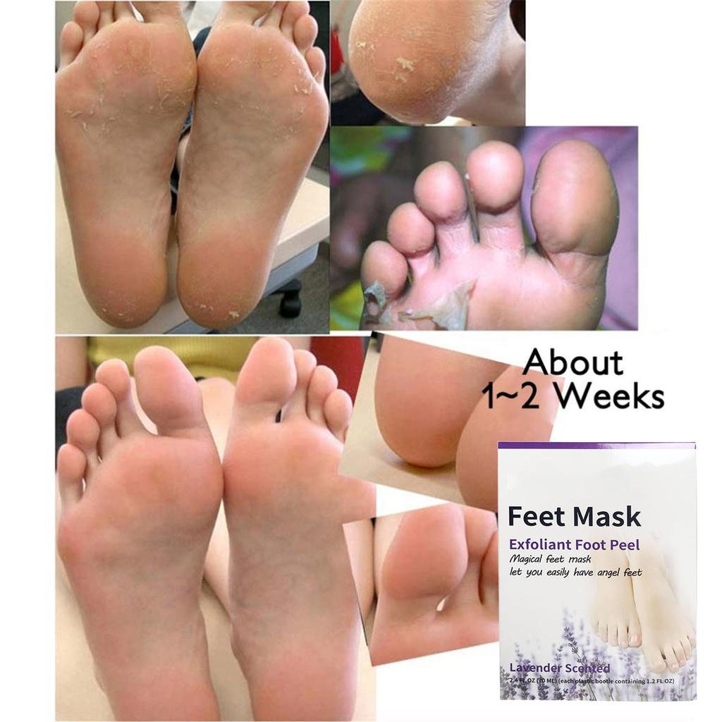 Foot Mask Exfoliating And Moisturizing Foot Mask Removing Dead Skin On The Heel And Moisturizing Foot Mask For Both Men And Women 70ml