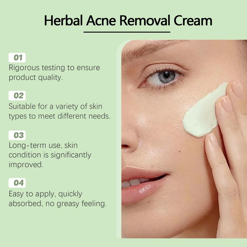 Крем для лица от прыщей, для лица и точек прыщей, натуральные растительные ингредиенты профессионально удаляют следы от прыщей, для подростков