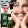 EELHOE чайное дерево против прыщей сыворотка для лица контроль масла сужение пор сыворотка от прыщей против прыщей отбеливание шрамов от прыщей удаление сыворотки для ухода за кожей