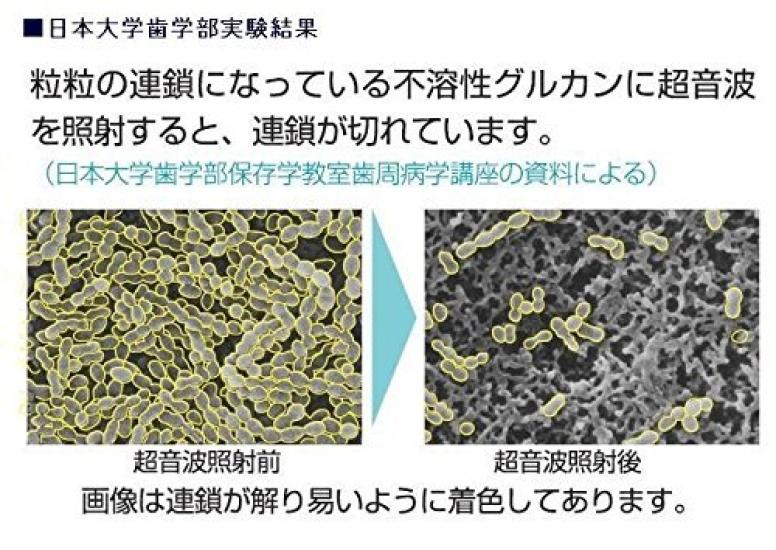 Ультразвуковая электрическая зубная щетка Smile X лавандового цвета с 2 упаковками сменных зубных щеток 1,6 МГц AU-300D