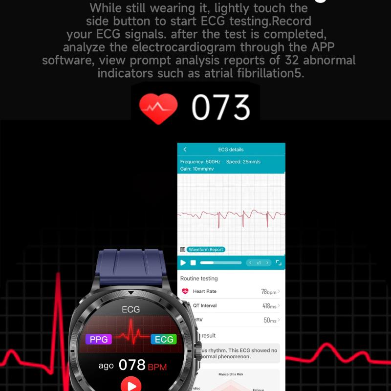 2025 НОВЫЕ Часы 7 Точное Измерение Жир в крови Артериальное давление Анализ тела Умные часы ЭКГ+ФПГ Часы Умные часы