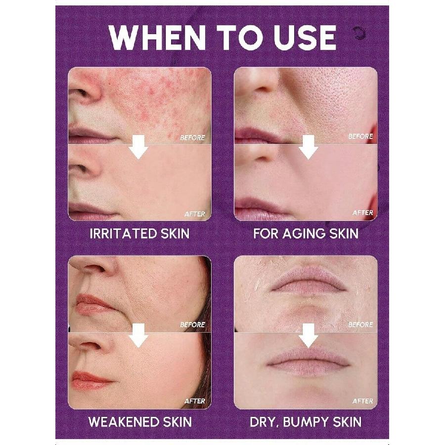 Восстанавливающий крем с расторопшей Banobagi 50 мл | Корейский уход за кожей Увлажняющее средство для лица Крем для лица для женщин и мужчин | Корейский увлажняющий крем Восстанавливающий крем для барьера W