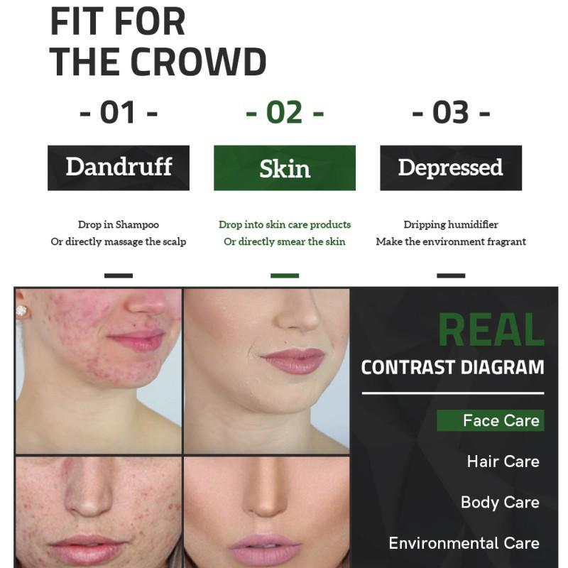 Эфирное масло чайного дерева, питающее кожу, сужает поры, контролирует масло, средство для ухода за кожей