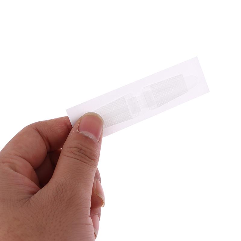 1 шт., пластырь на молнии, безболезненное устройство для закрытия ран, без швов, пластыри для повязки на рану, пластырь для уменьшения швов на молнии