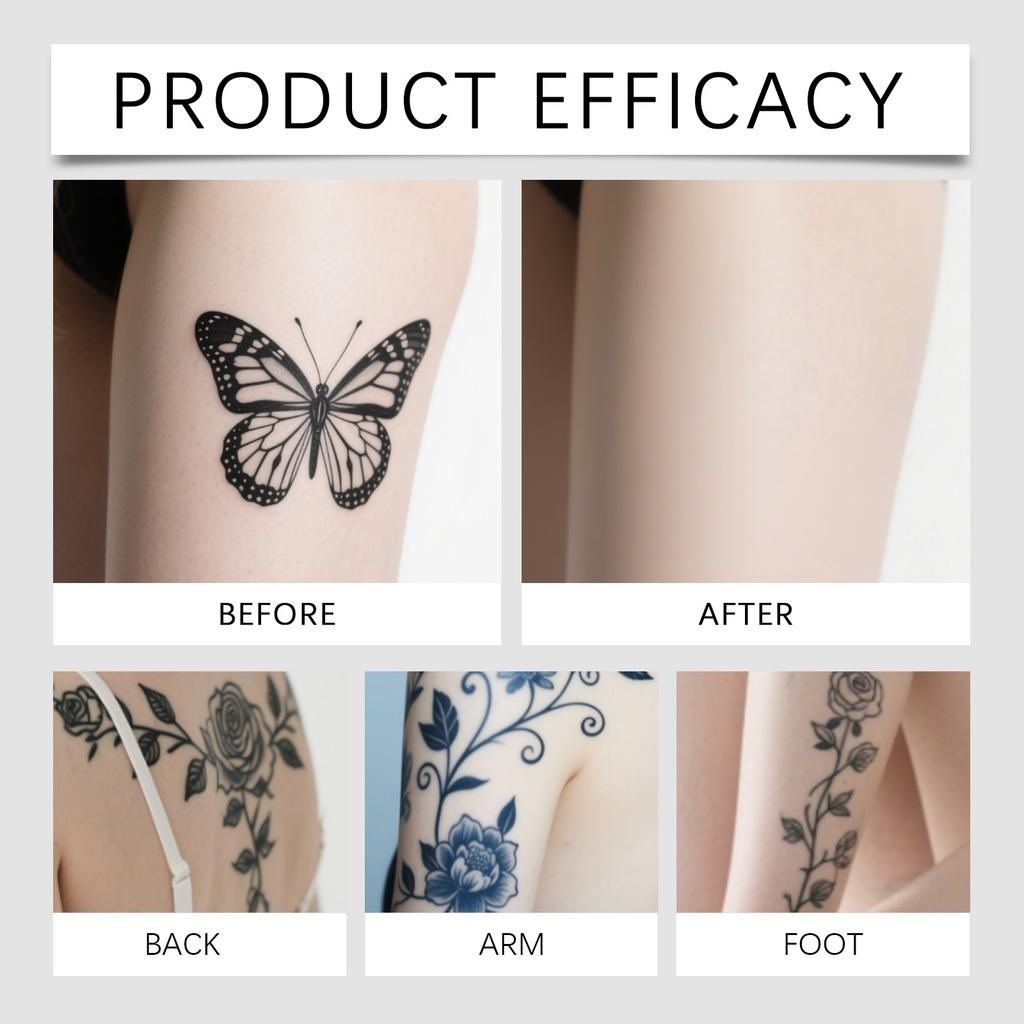 Concealer Covering Patches, Scar Covering Patches, Ultra-thin Patches, Skin-friendly And Breathable Temporary Covering Needs