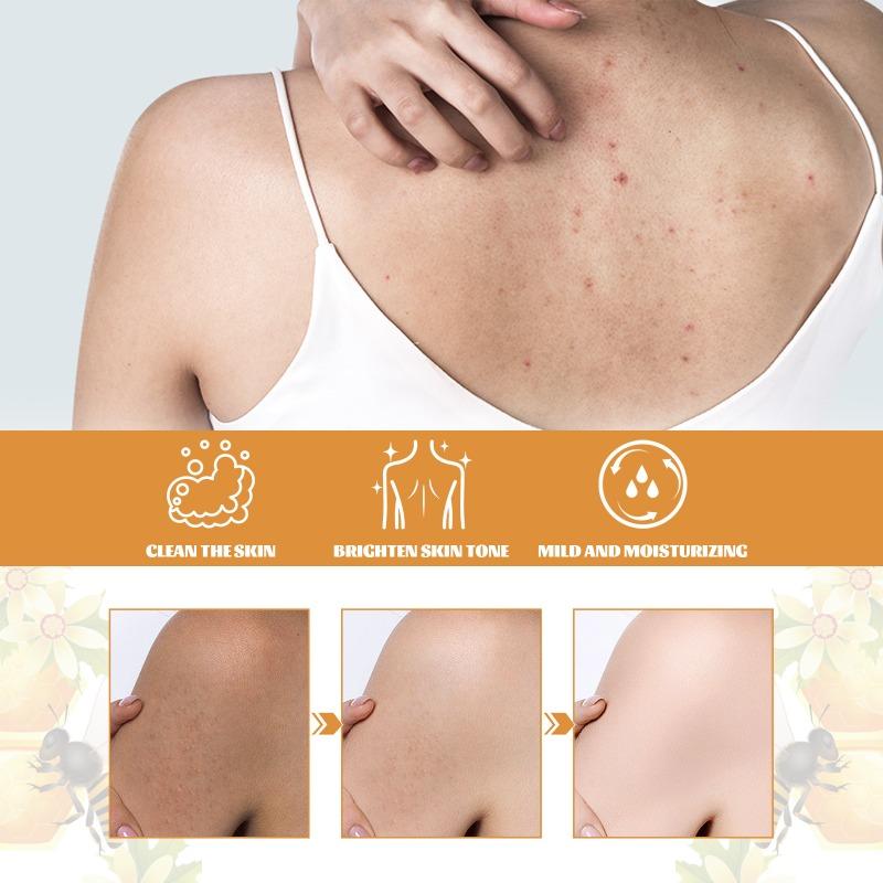 Медовый гель для душа Глубокое очищение Отшелушивание Увлажнение Красота Укрепление Отбеливание Кожа тела Гель для душа