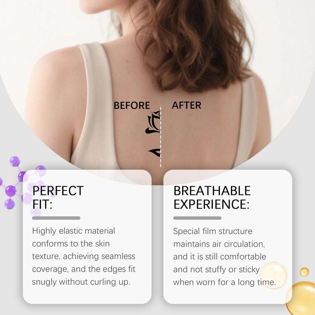 Concealer Covering Patches, Scar Covering Patches, Ultra-thin Patches, Skin-friendly And Breathable Temporary Covering Needs