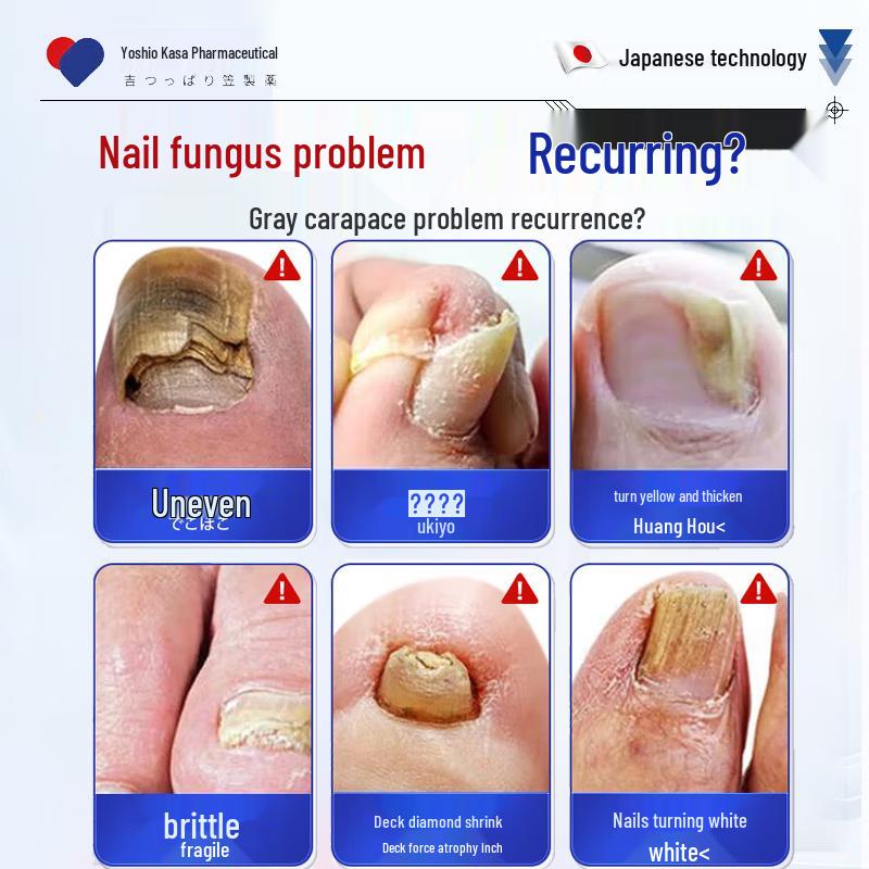 Fungal Nail Treatment Liquid