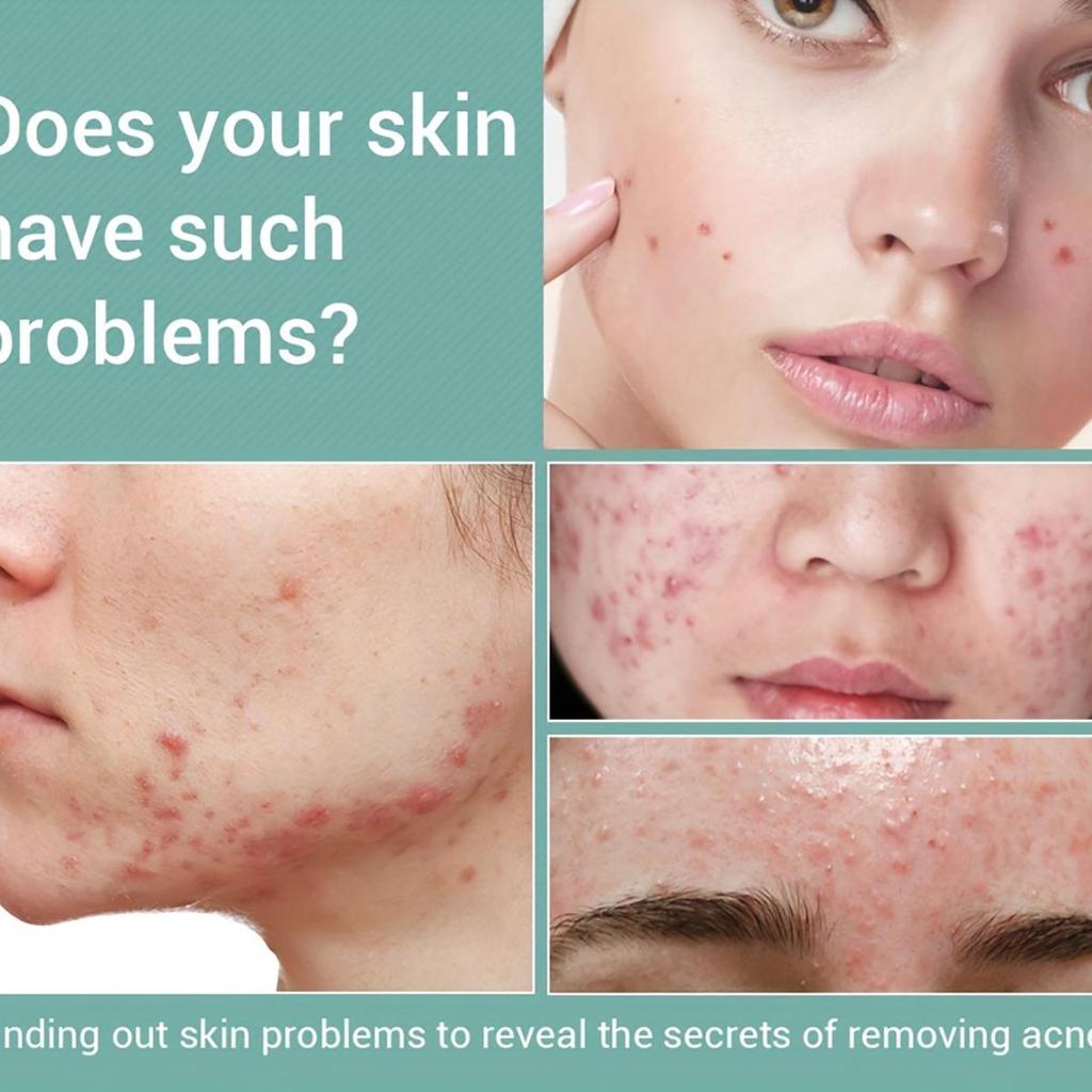 Средство для удаления темных кругов, уход за глазами, отбеливающий крем для лица для женщин crema para manchas en la piel, отбеливающий крем для кожи