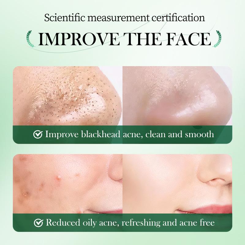 Чистая маска из полыни, палочка для лечения прыщей, крем для удаления черных точек, глубоко очищающая поры, осветляющая очищающая глиняная грязевая маска из полыни