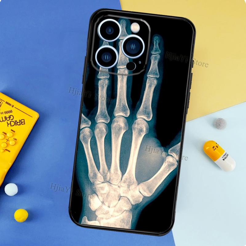 Skeleton Art Case For iPhone 11 14 15 16 Plus Soft Phone Cover For iPhone XR X XS 12 13 Pro MAX Mini