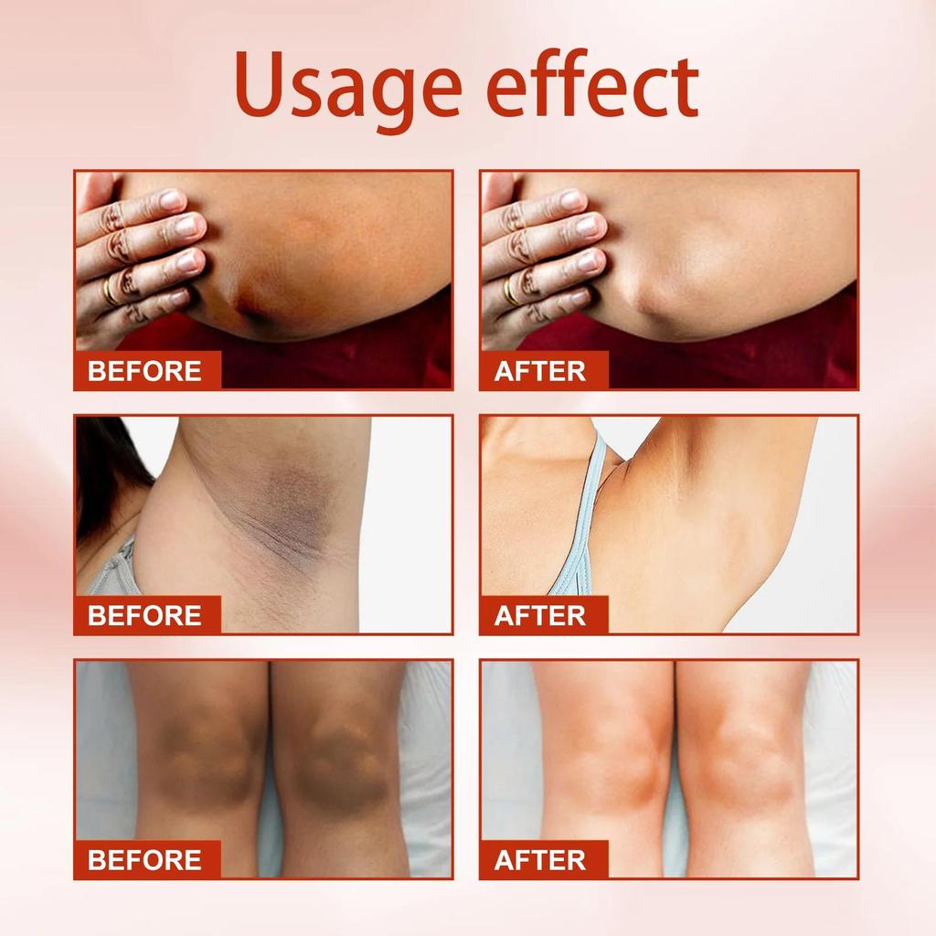 Крем для кожи увлажняет, питает и осветляет кожу.. Лосьон для тела, уменьшающий тусклость кожи и осветляющий крем для кожи