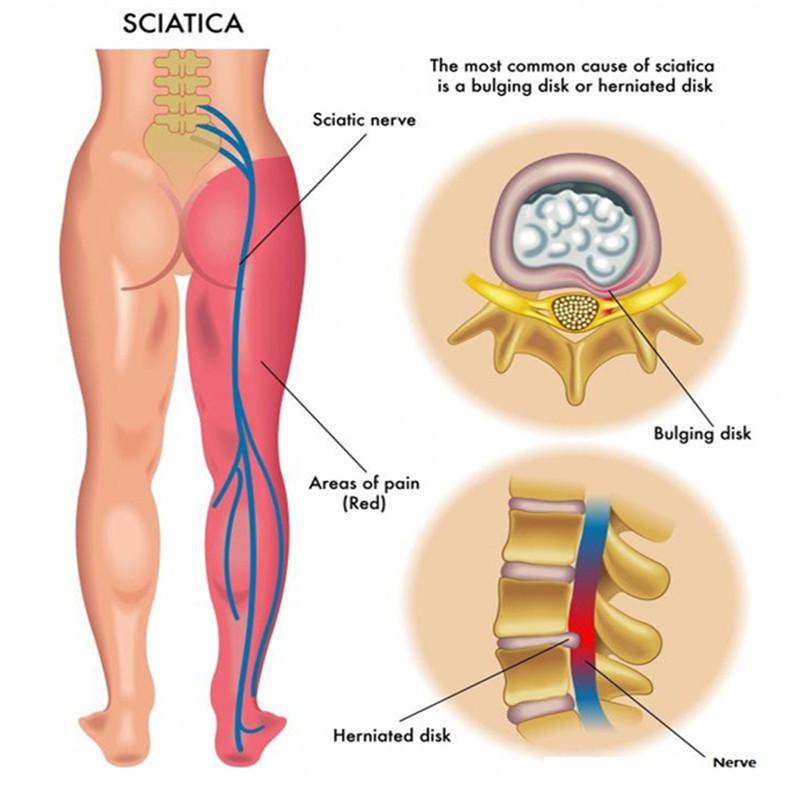 Противовоспалительные масла Пластыри с противовоспалительными маслами Патчи от боли в мышцах, синяках и отеках с тайским тигровым маслом