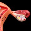 Pathological Uterus Ovary Anatomical Model Anatomy Cross Section Study Tool
