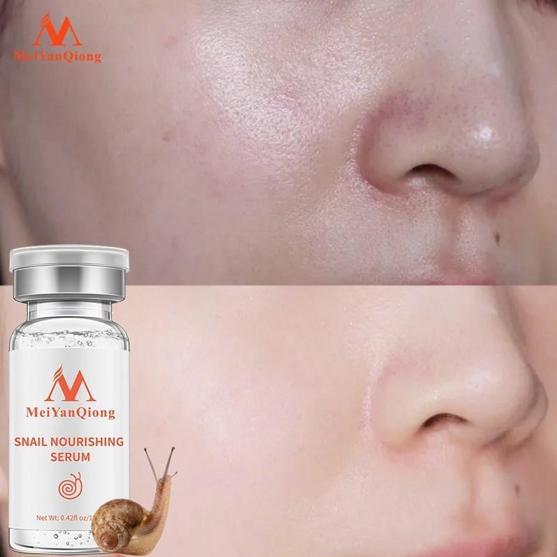High Quality Snail100% Essence Hyaluronic Acid Liquid Whitening Spot Essence Shrink Pores Ampoule Anti-acne Regenerative Essence