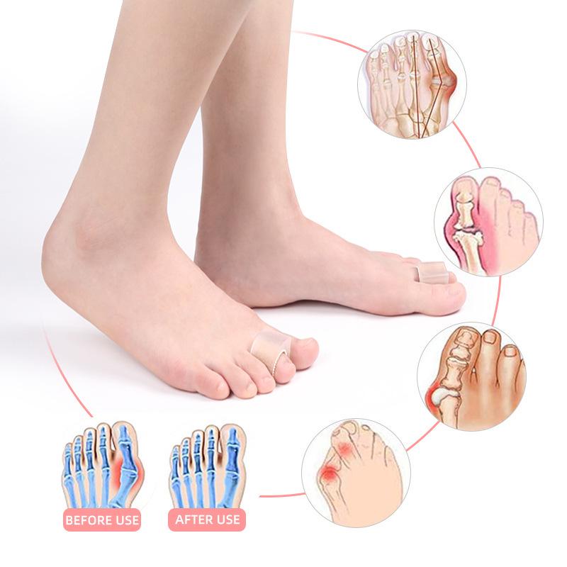 Силиконовый разделитель пальцев ног (SEBS): Облегчение при Hallux Valgus и косточке на большом пальце ноги