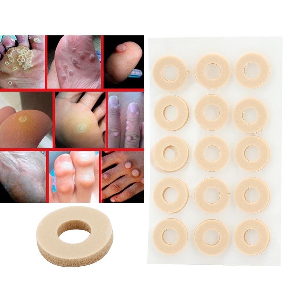 15 шт пластырь для удаления мозолей на ногах, облегчение боли в ногах, уход за здоровьем ног