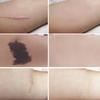 New 6PCS Tattoo Cover Up Skin Color Scar Concealer Sticker Portable Flaw Birthmark Concealing Waterproof Beauty Cosmetic Tools