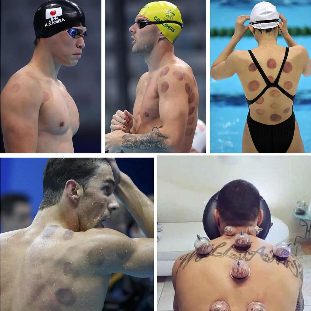 Cupping Set, Cupping Therapy Sets,12/18/24 Cups Professional Chinese Cupping Set for Massage Back, Pain Relief, Physical Therapy, Massage Therapy Kit