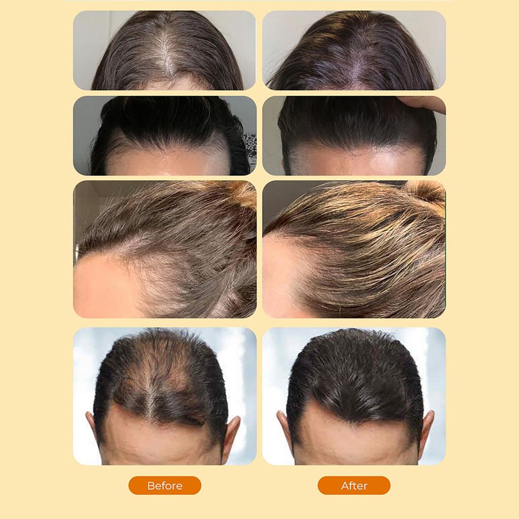 Успокаивает кожу головы, улучшает волосяные фолликулы, способствует росту волос, увлажняет и защищает волосы, 60 мл