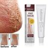 30g Chapped Foot Ointment Autumn and Winter Heel Anti-cracking Moisturizing Foot Repair Gel