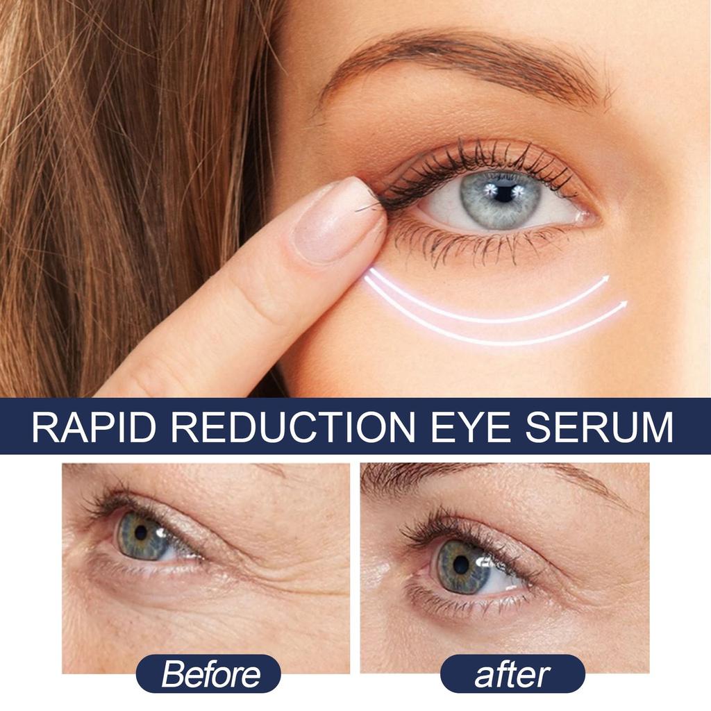 Lighten Eye Wrinkle Moisturizes And Hydrates The Eye Area Repairs The Skin Firming, Lifting And Smoothing Fine Lines5ml