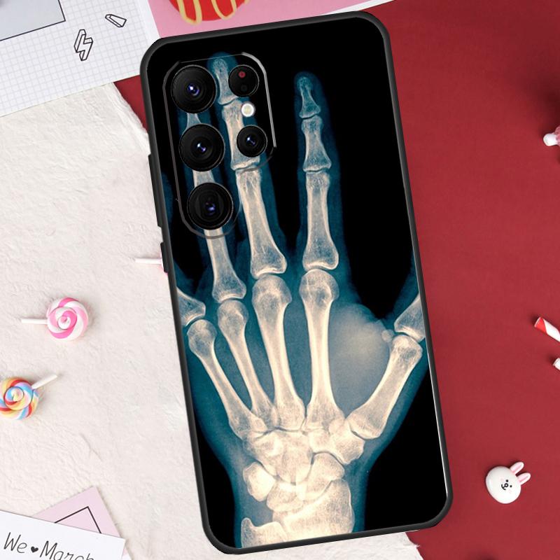Арт-кейс "Скелет" для Samsung Galaxy S26 Ultra S23 S22 S21 S20 S24 S25 Ultra S10 Plus S25 FE Защитный чехол