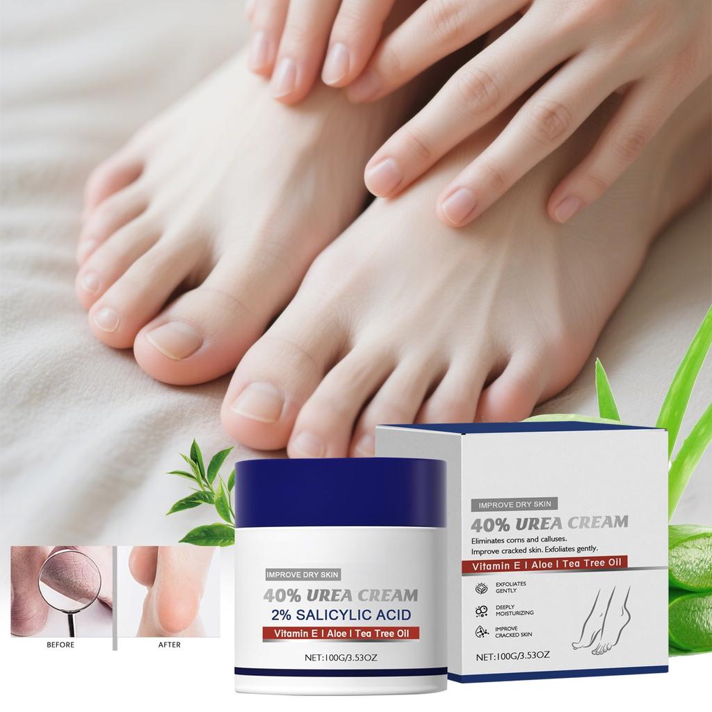 Крем для ног с мочевиной 40%, крем для ухода за потрескавшейся кожей ног и рук, 100 г