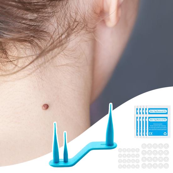Удалитель папиллом Удобный в использовании одной рукой Для домашнего использования Безопасный Эффективный Устройство для удаления папиллом Набор для личной гигиены
