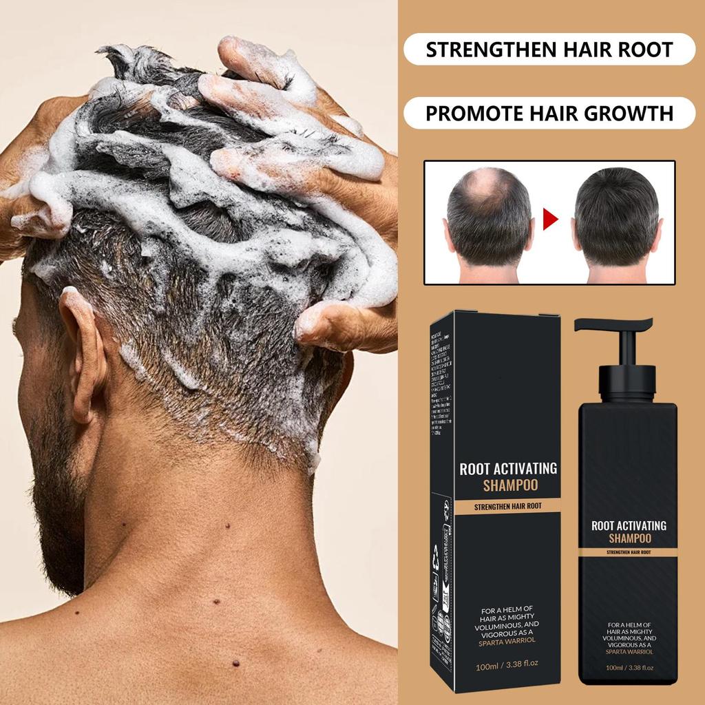 Hair Loss Treatment Shampoo Promotes Growth, Strengthens Roots, Repairs Scalp, Anti-Thinning
