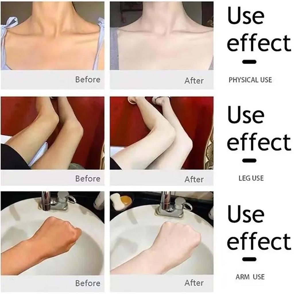 Подмышки Бедра Черный крем для удаления Отбеливание и осветление Разбавление Осветление тона кожи Восполнение влаги