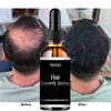 Сыворотка для роста волос, спрей, жидкость для быстрого роста волос, средство для лечения волосяного фолликула кожи головы, против выпадения волос, естественная красота, здоровье, уход за волосами