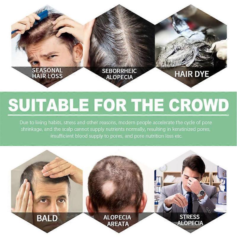 3x Hair Growth Essential Oils Products Rosemary Licorice Root Extract Essence Fast Regrowth Serum Beard Growth Oil Hair Loss Care Beauty Scalp Treatme