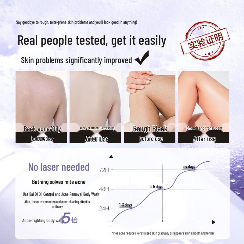 Botei Oil Control Anti-Acne Body Wash