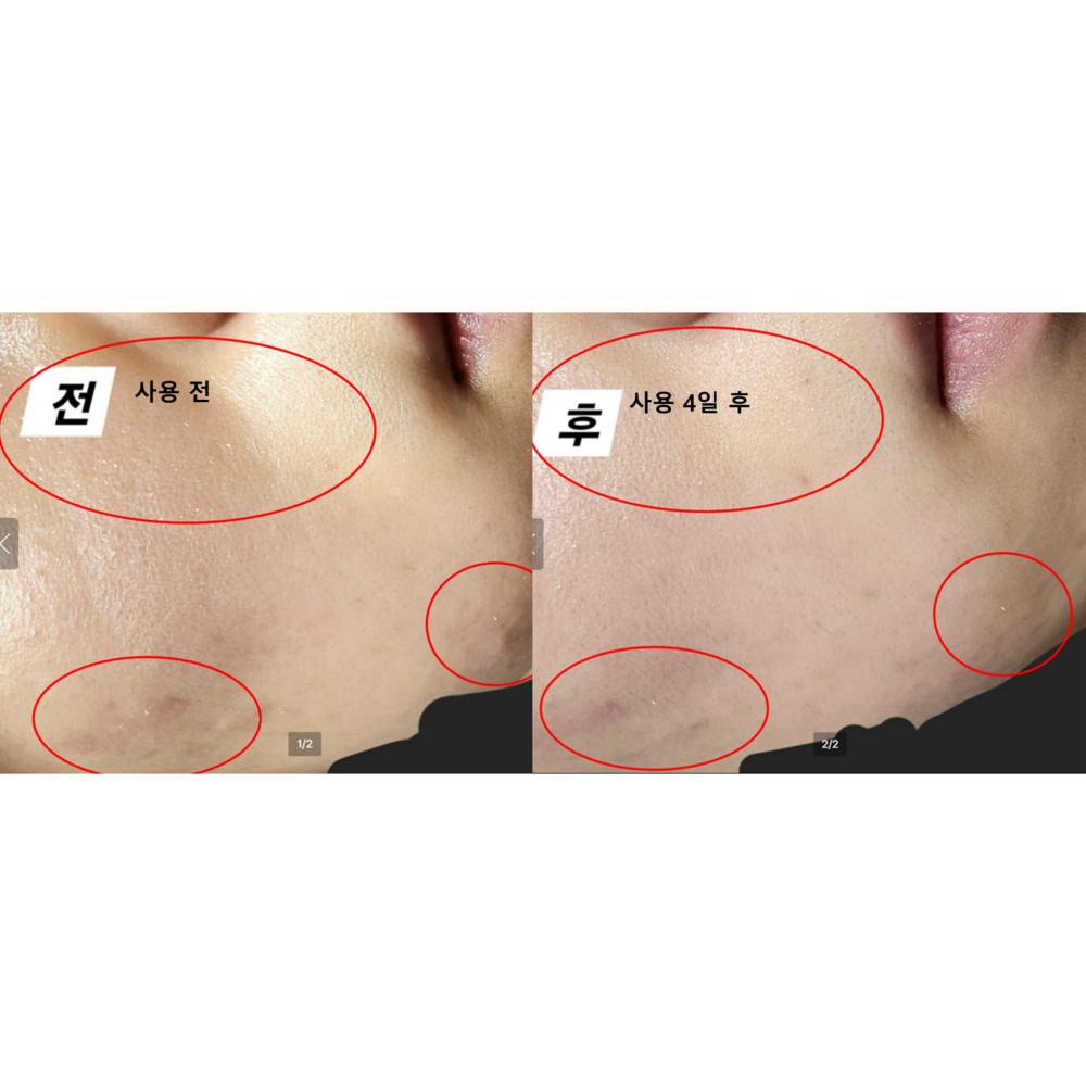 [Пищевая добавка для здоровья кожи, созданная фармацевтом] Программа ухода за кожей ONGI earthy