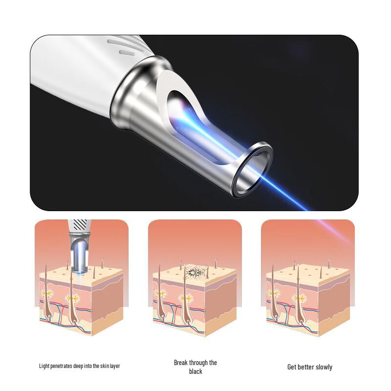 Портативная лазерная пикосекундная ручка для удаления пигмента