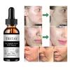5ML/15ML/30ML/50ML/TRSTAY Solves Skin Problems and Keeps Your Face Locked In Water Smoothly, Keeping It Moist
