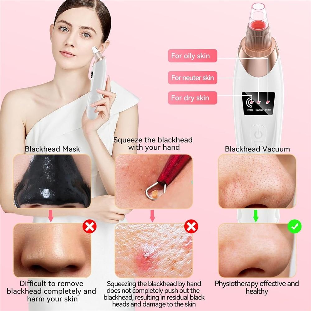 Electric Blackhead Vacuum Cleaner 4-Level Suction Modes Blackhead Removal Tool with Heating Mode