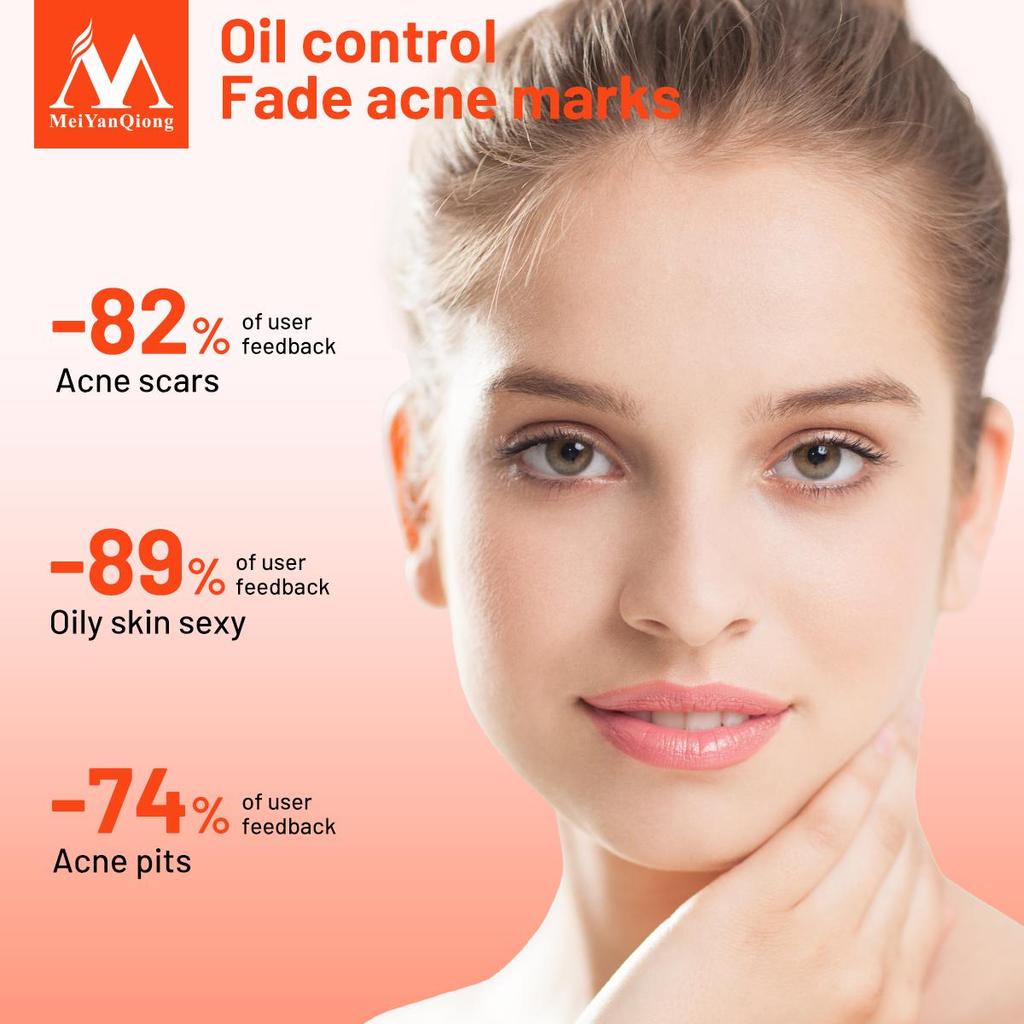 Сыворотка на травах против акне, предотвращает появление морщин. Уменьшает поры. Контролирует жирность кожи лица