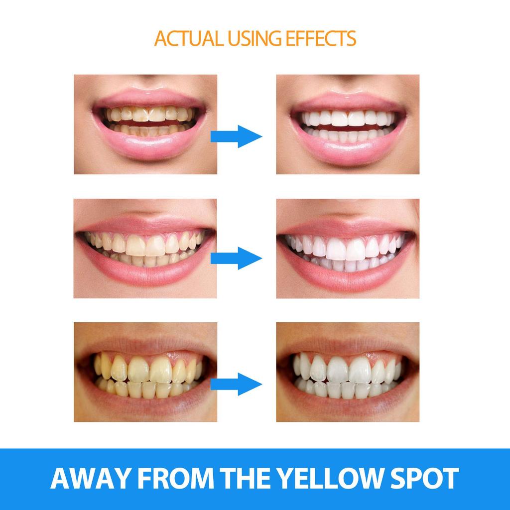 1шт/2шт CHUMOLEE карандаш для отбеливания зубов, очищает желтые зубы и удаляет пятна