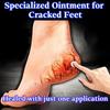 Heel, Chapped, Cracked, Chapped, Cracked, Fungal Infection, Special Ointment for Peeling and Cracking Hands and Feet