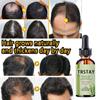Hairloss Hair Growth Tool Hair Laser Growth Rosemary Mint Scalp & Hair Strengthening Oil Growth Gins