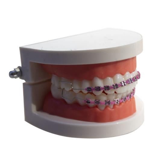 Temporary Tooth Decoration with Metal Wires Brackets Orthodontic Ligatures Orthodontists Explain Dental Students Practice Props