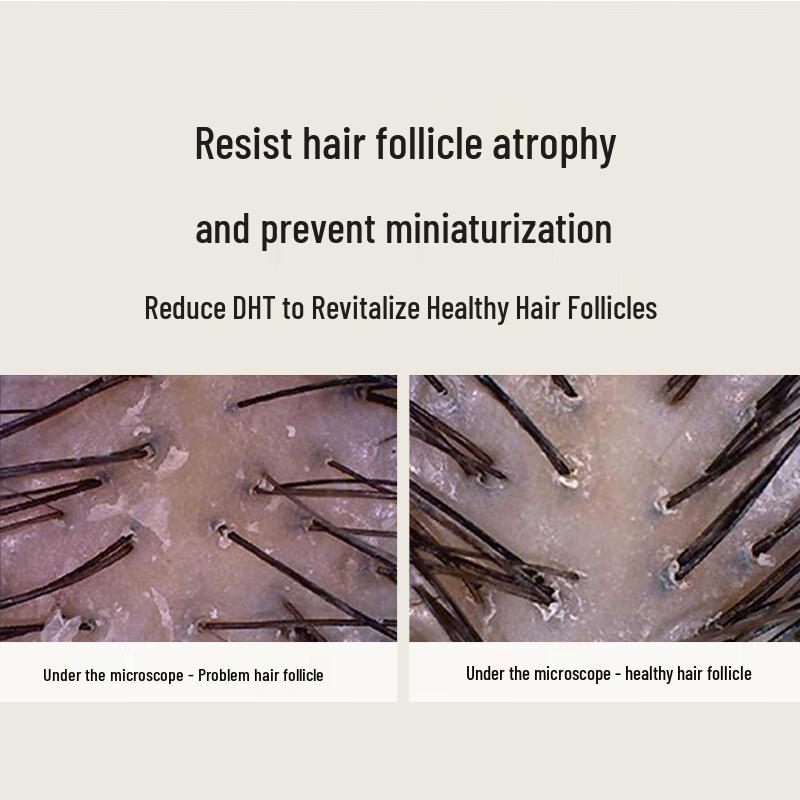 Hathaway Herbal Anti-Dandruff Shampoo & Conditioner Set