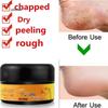 Horse Oil Hand and Foot Repair Cream Foot Cream Care Cream Beriberi and Itchy Feet Blisters Prevent Chapped