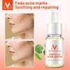 Centella Asiatica Acne Removing Essence Face Serum Liquid Moisturizing Anti Wrinkle Shrink Pore Control Oil Whiten Skin