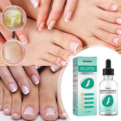 30 мл 1 FL OZ Toenail Fix Liquid для фиксации ногтей, гнилых ногтей, мягких ногтей на ногах, мягких ногтей на ногах, ярких ногтей,