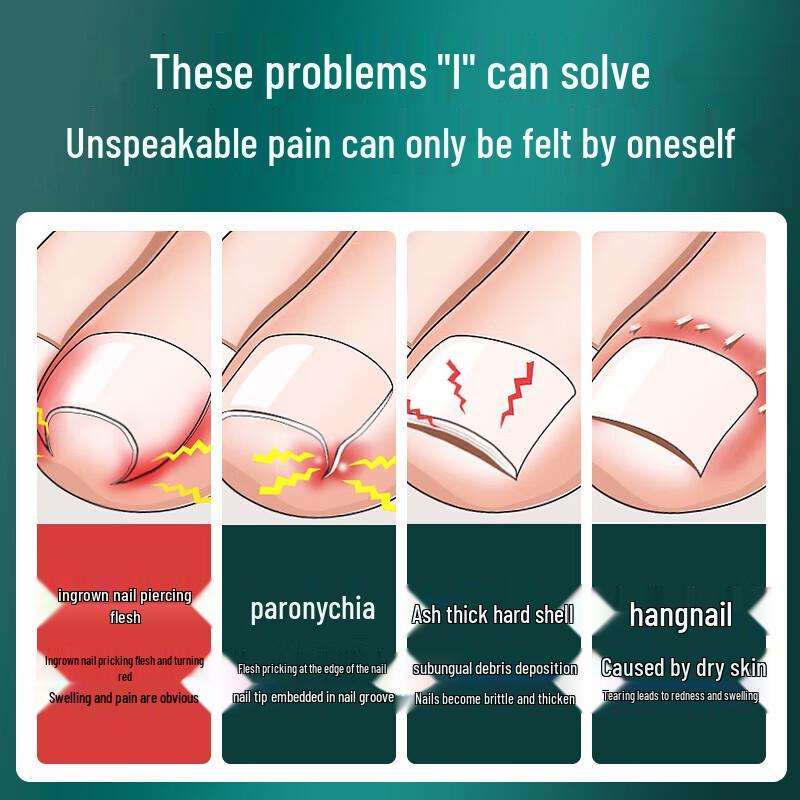 MR.GREEN Ingrown Toenail Clipper Set