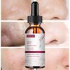 Face Essence Essential Oils Anti Wrinkle Anti-aging Lighten Spots Brightening Facial Skin Fade Remove Freckle Speckle Care